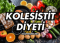 Kolesistit Diyeti Nedir? Nasıl Yapılır?