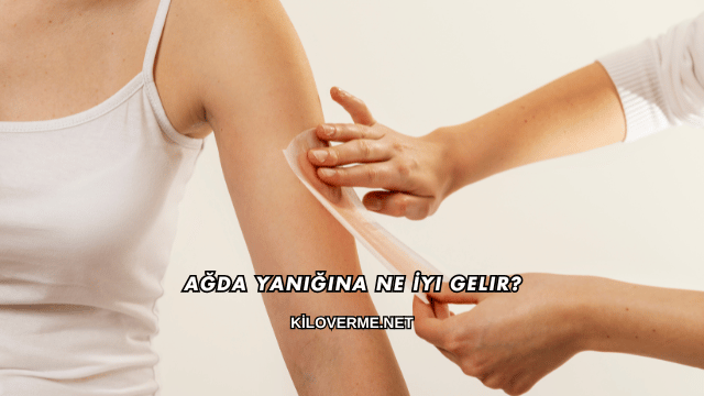 Ağda Yanığına Ne İyi Gelir?