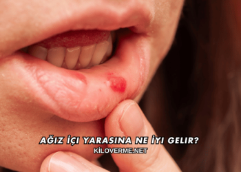 Ağız İçi Yarasına Ne İyi Gelir?