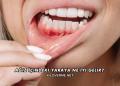 Ağız İçindeki Yaraya Ne İyi Gelir?