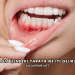 Ağız İçindeki Yaraya Ne İyi Gelir?