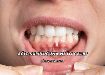 Ağız Kuruluğuna Ne İyi Gelir?