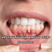 Ağız Kuruluğuna Ne İyi Gelir?