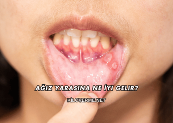 Ağız Yarasına Ne İyi Gelir?