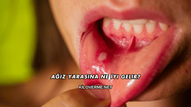 Ağız Yarasına Ne İyi Gelir?