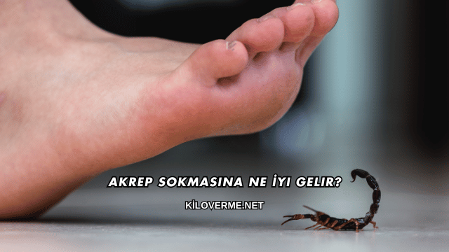 Akrep Sokmasına Ne İyi Gelir?