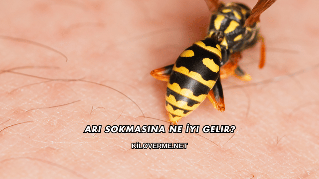 Arı Sokmasına Ne İyi Gelir?