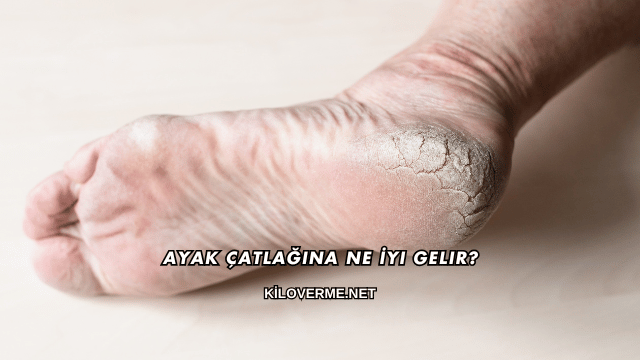 Ayak Çatlağına Ne İyi Gelir?