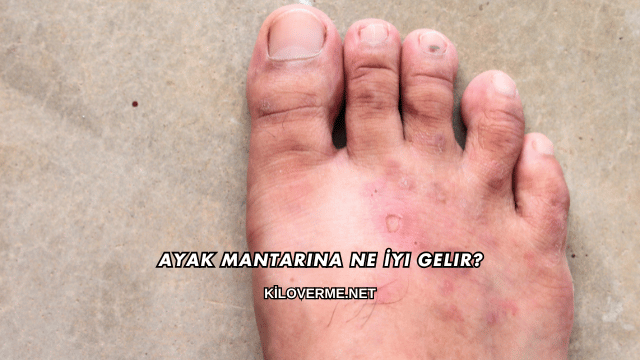 Ayak Mantarına Ne İyi Gelir?