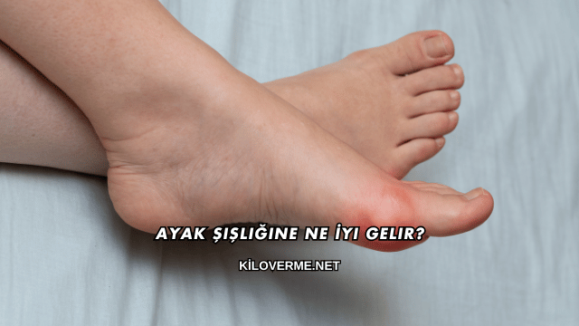 Ayak Şişliğine Ne İyi Gelir?