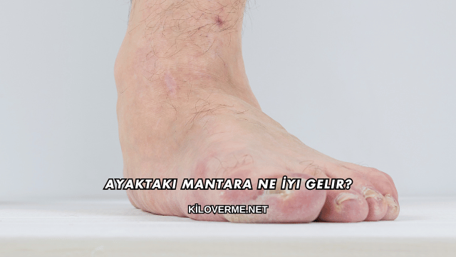 Ayaktaki Mantara Ne İyi Gelir?