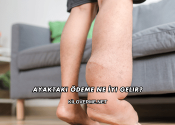 Ayaktaki Ödeme Ne İyi Gelir?