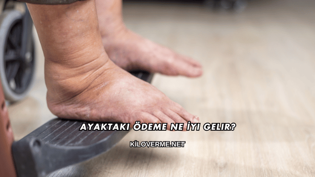 Ayaktaki Ödeme Ne İyi Gelir?