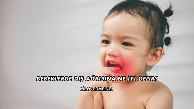 Bebeklerde Diş Ağrısına Ne İyi Gelir?
