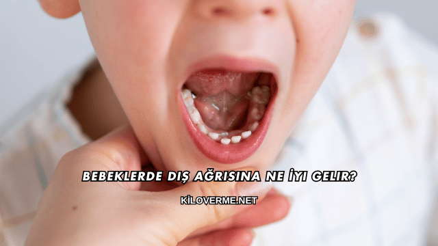 Bebeklerde Diş Ağrısına Ne İyi Gelir?