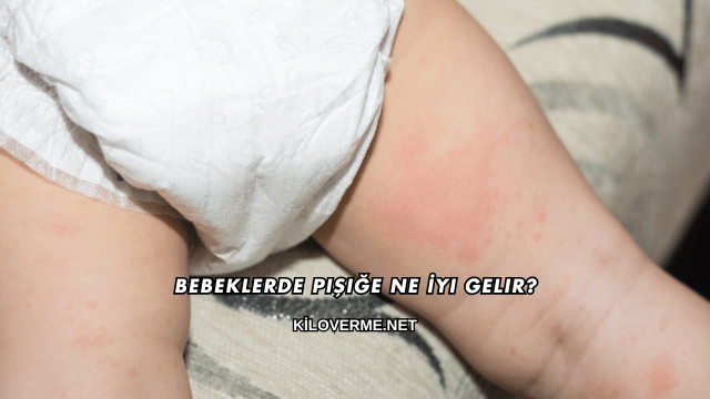 Bebeklerde Pişiğe Ne İyi Gelir?