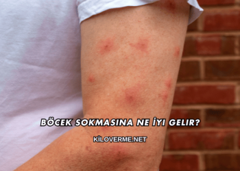 Böcek Sokmasına Ne İyi Gelir?