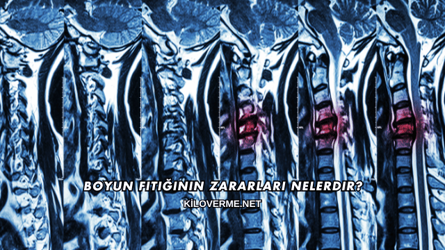 Boyun Fıtığının Zararları Nelerdir?