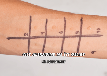 Cilt Alerjisine Ne İyi Gelir?