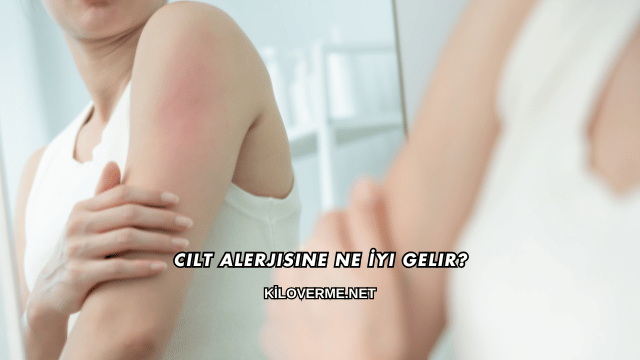 Cilt Alerjisine Ne İyi Gelir?