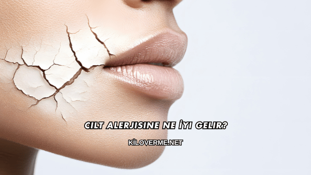 Cilt Alerjisine Ne İyi Gelir?