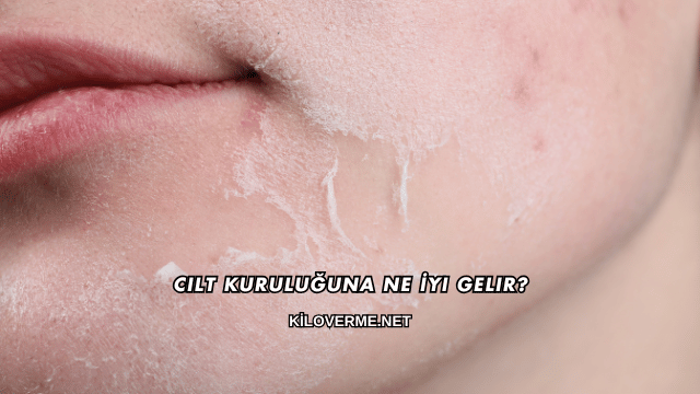 Cilt Kuruluğuna Ne İyi Gelir?