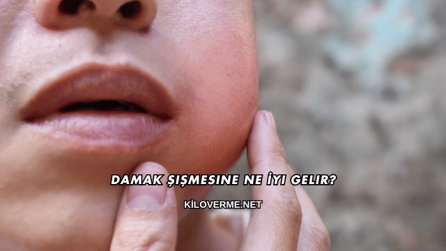 Damak Şişmesine Ne İyi Gelir?