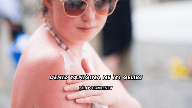 Deniz Yanığına Ne İyi Gelir?