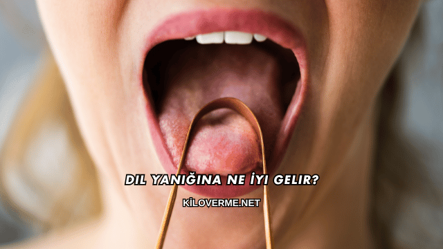 Dil Yanığına Ne İyi Gelir?