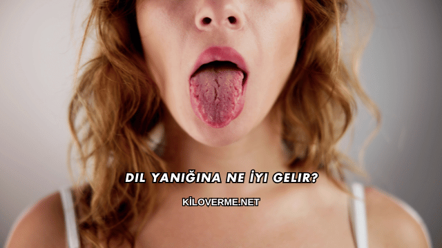 Dil Yanığına Ne İyi Gelir?