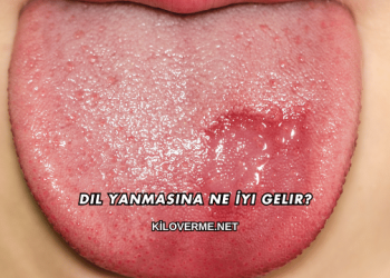 Dil Yanmasına Ne İyi Gelir?
