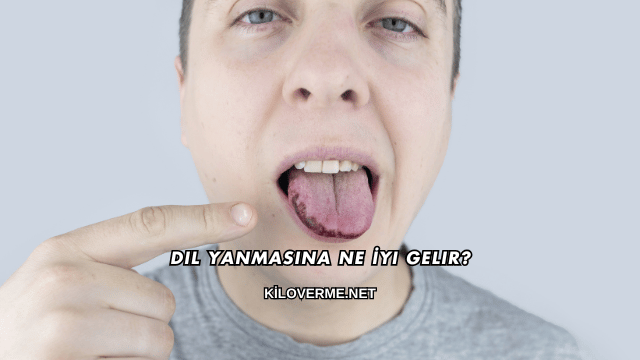 Dil Yanmasına Ne İyi Gelir?