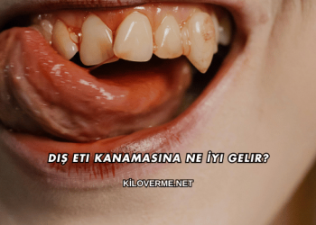 Diş Eti Kanamasına Ne İyi Gelir?