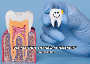 Diş Kistinin Zararları Nelerdir?