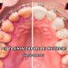 Diş Taşının Zararları Nelerdir?