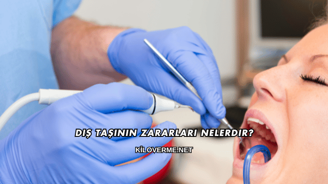 Diş Taşının Zararları Nelerdir?