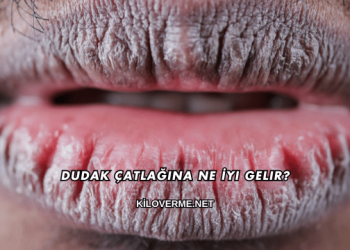 Dudak Çatlağına Ne İyi Gelir?