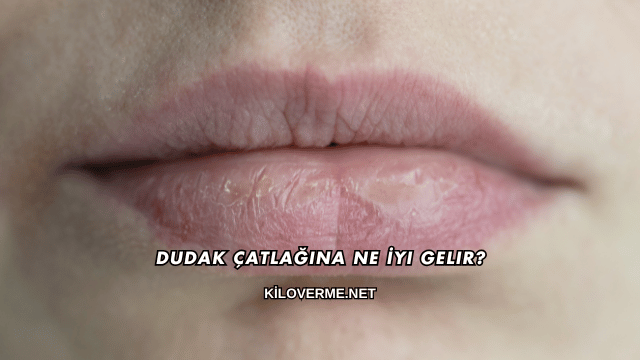 Dudak Çatlağına Ne İyi Gelir?