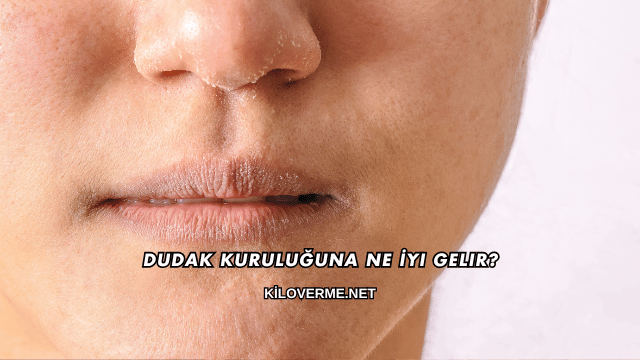 Dudak Kuruluğuna Ne İyi Gelir?