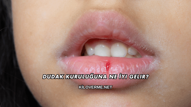 Dudak Kuruluğuna Ne İyi Gelir?