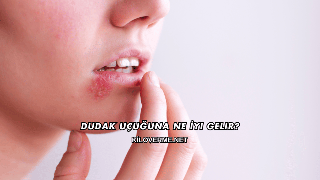 Dudak Uçuğuna Ne İyi Gelir?