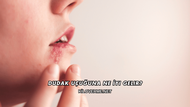 Dudak Uçuğuna Ne İyi Gelir?