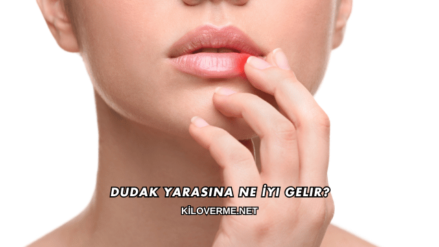 Dudak Yarasına Ne İyi Gelir?