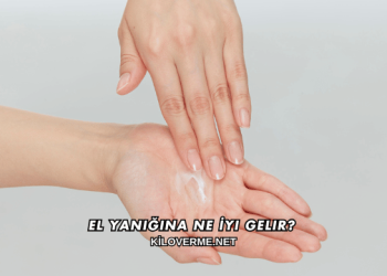 El Yanığına Ne İyi Gelir?