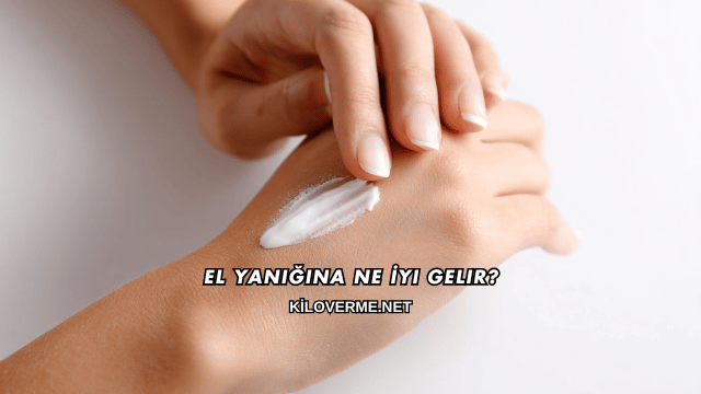 El Yanığına Ne İyi Gelir?