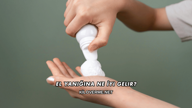 El Yanığına Ne İyi Gelir?