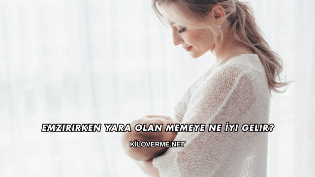Emzirirken Yara Olan Memeye Ne İyi Gelir?