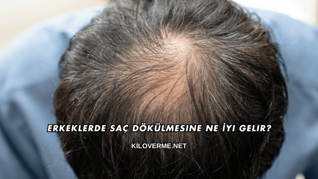 Erkeklerde Saç Dökülmesine Ne İyi Gelir?