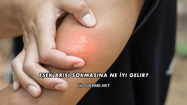 Eşek Arısı Sokmasına Ne İyi Gelir?