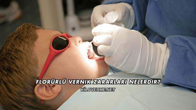 Florürlü Vernik Zararları Nelerdir?
